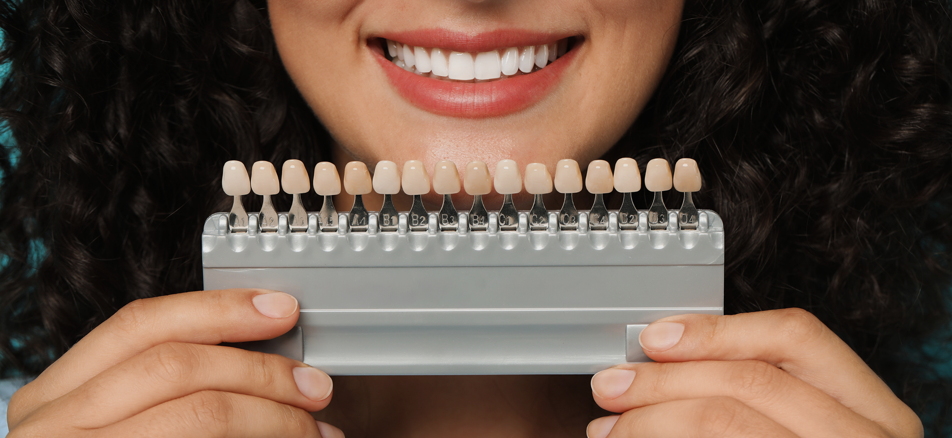 Teeth Whitening